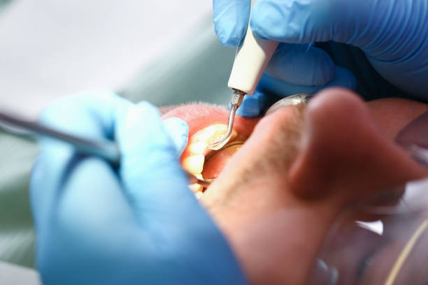 Best Emergency Dental Care for Broken or Chipped Teeth in Nettleton, MS