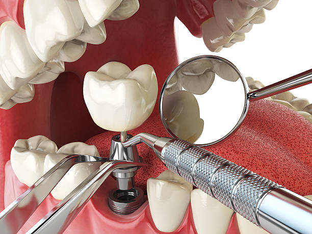 Best Emergency Treatment for Dental Infections or Abscesses in Nettleton, MS